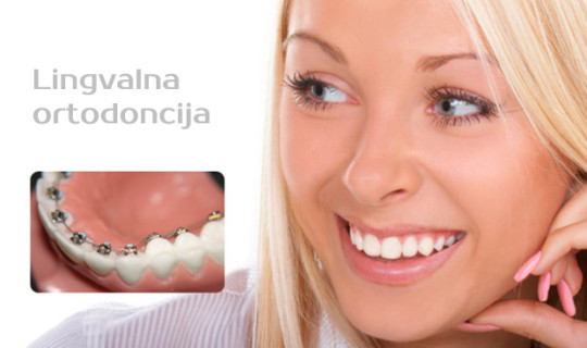 Lingvalna ortodoncija