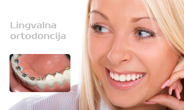 Lingvalna ortodoncija